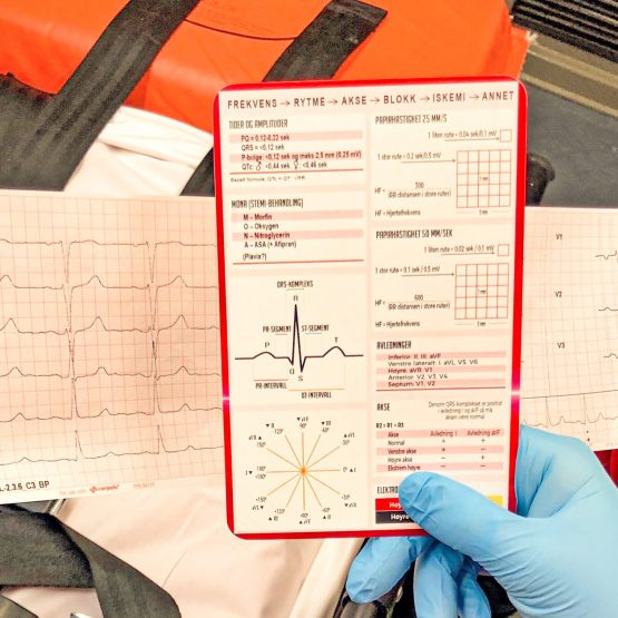 EKG-tolkning-ambulanse-cingulum-2