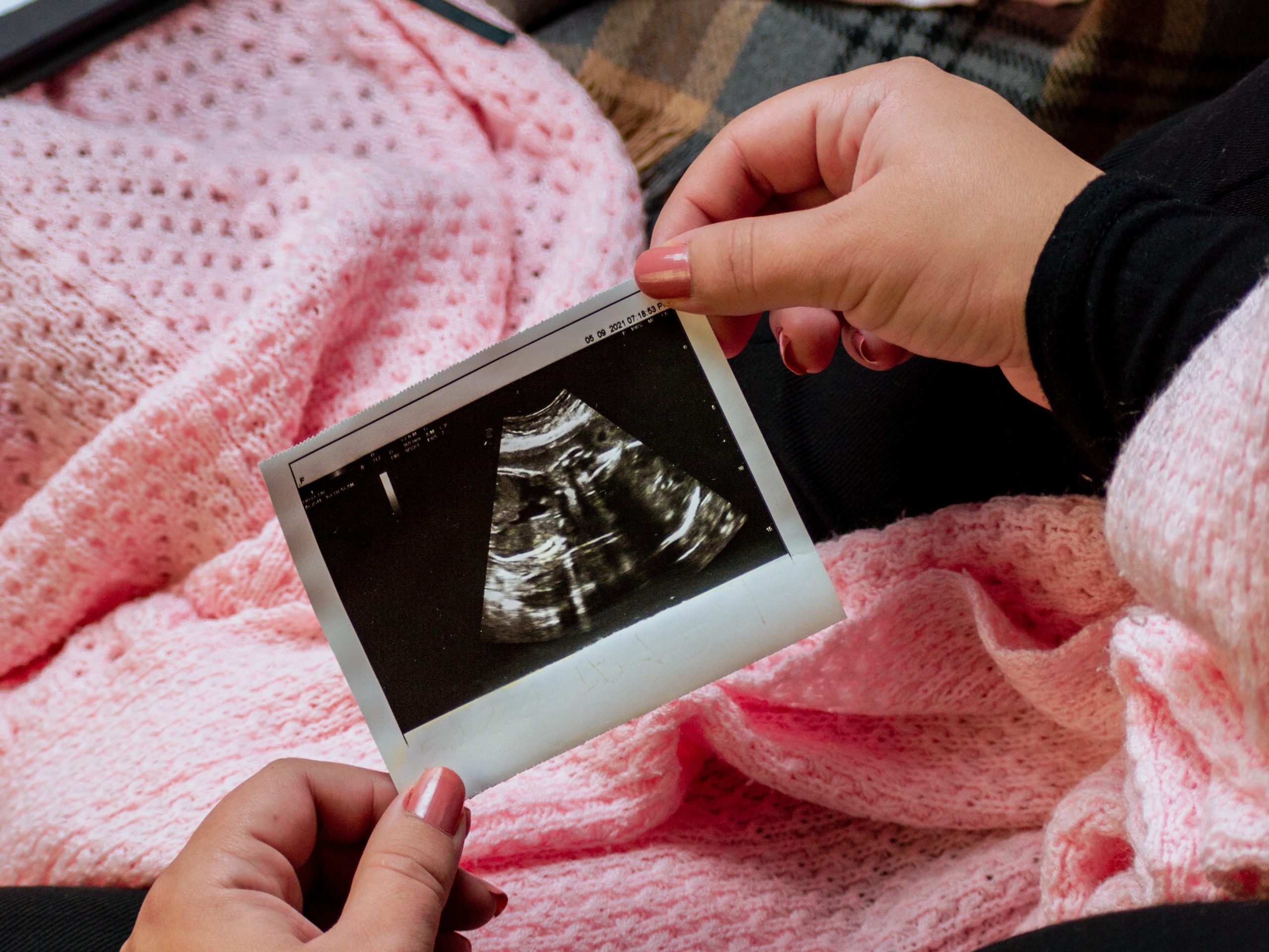 ultralyd-graviditet-cingulum