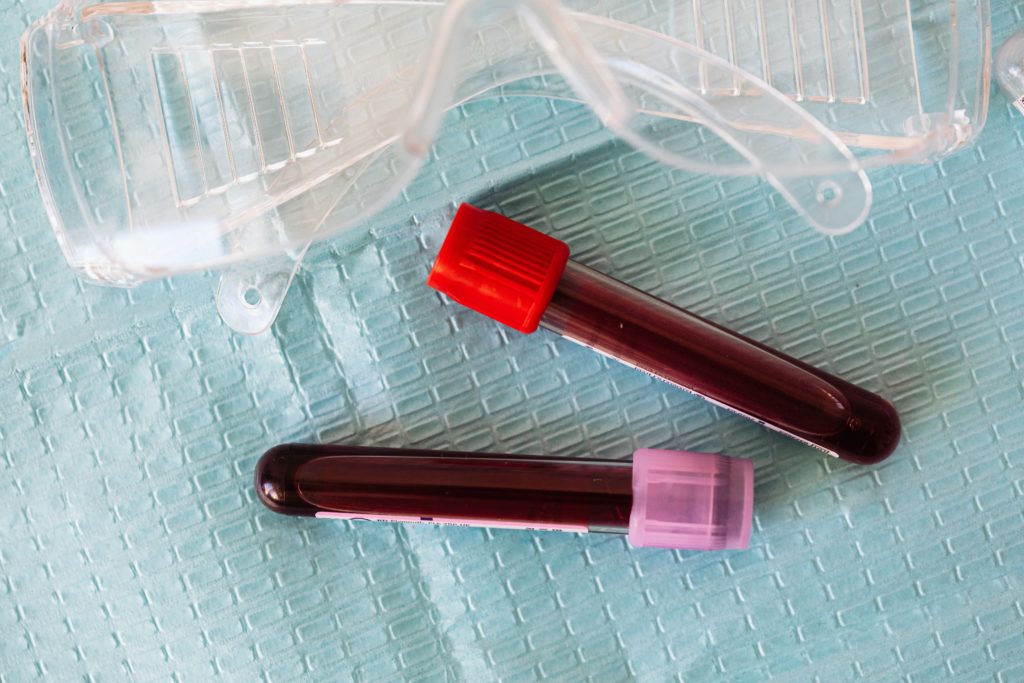 blodprøver-cingulum